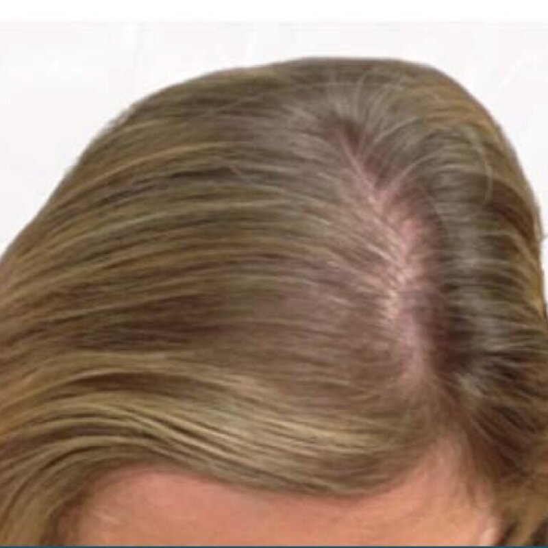 gethairmd Before & After Image