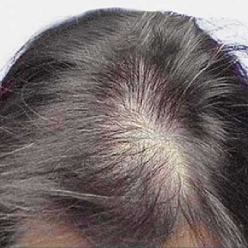 gethairmd Before & After Image