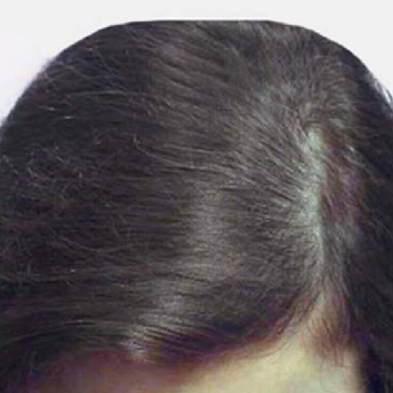 gethairmd Before & After Image
