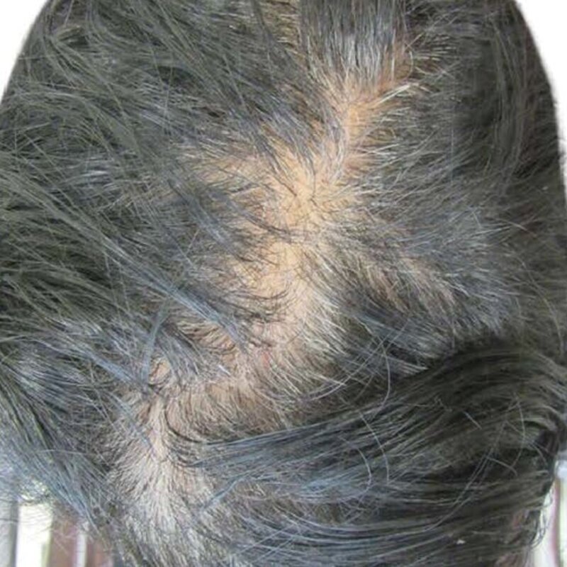 gethairmd Before & After Image