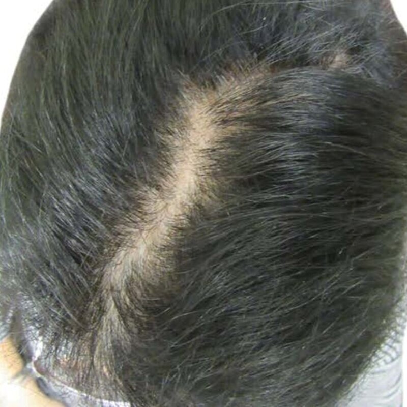 gethairmd Before & After Image