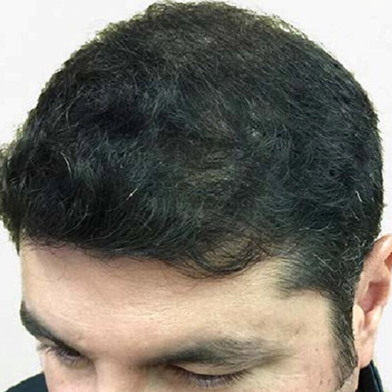 GetHairMD Before & After Image