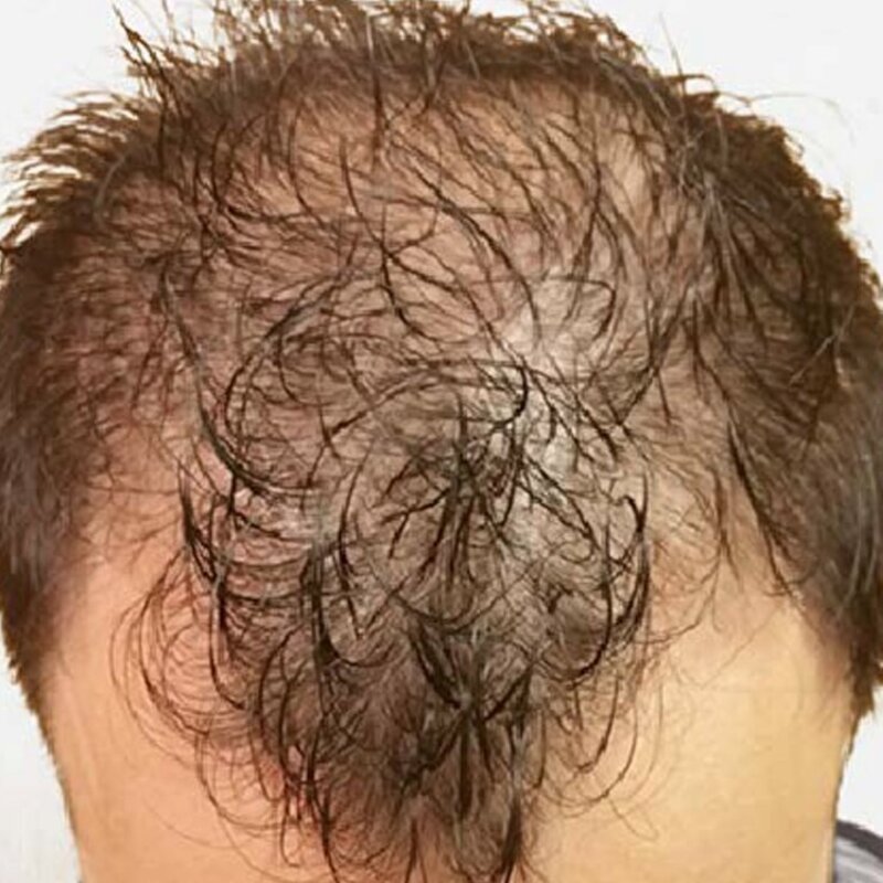 GetHairMD Before & After Image