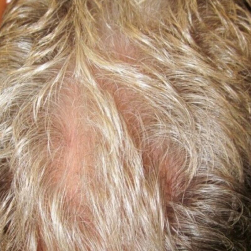 GetHairMD Before & After Image