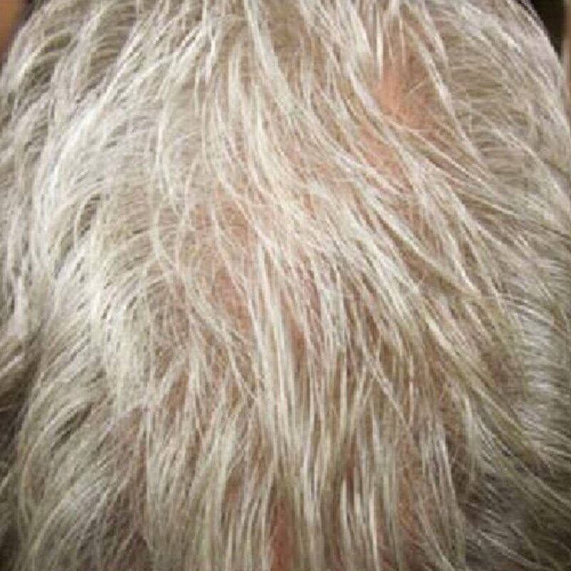 GetHairMD Before & After Image